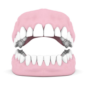 mockup-of-dentures