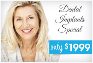 dental-implants-special