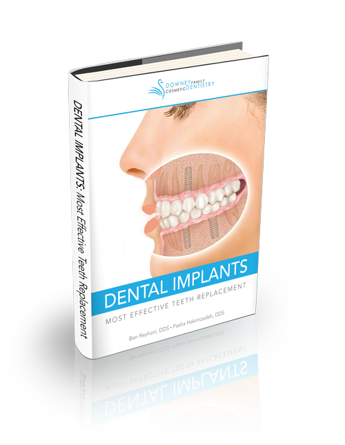 Dental-Implants-eBook-Graphic