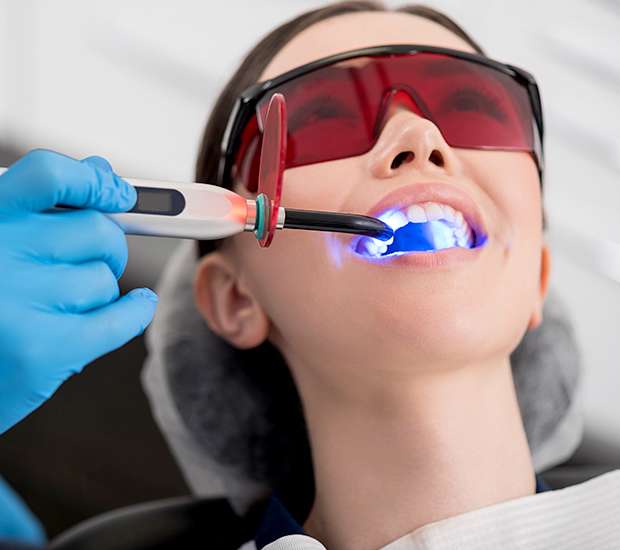 Downey Professional Teeth Whitening