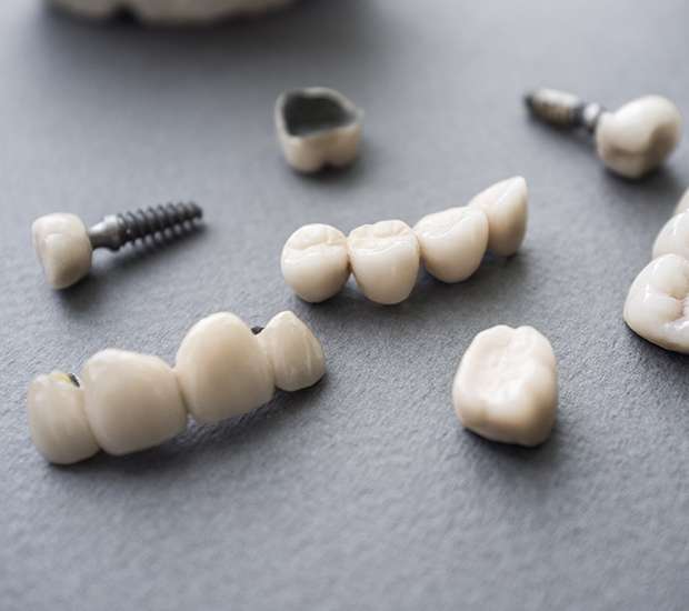 Downey The Difference Between Dental Implants and Mini Dental Implants